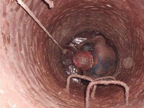 管道疏通被炸伤了怎么办(被管道疏通剂烧伤怎么办) 管道疏通被炸伤了怎么办(被管道疏通剂烧伤怎么办)