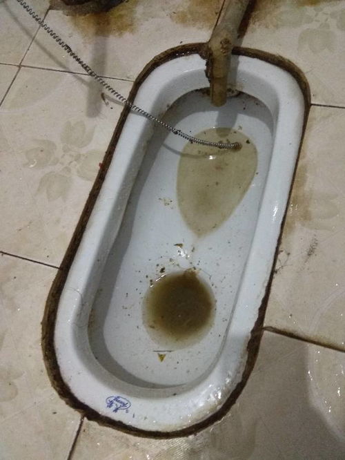 棉絮渣堵下水管道怎么疏通(棉花堵住下水道怎么办)