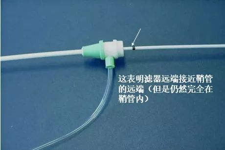 优固洁管道疏通器怎么用(优固洁管道疏通器怎么用图解)
