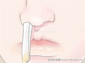鼻腔管道疏通器怎么用的(鼻腔管道疏通器怎么用的啊) 鼻腔管道疏通器怎么用的(鼻腔管道疏通器怎么用的啊)