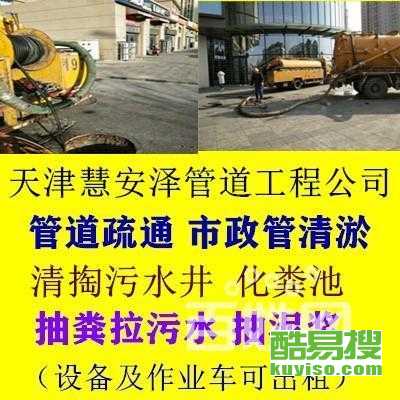 天津市管道疏通怎么收费(天津管道疏通一般要多少钱) 天津市管道疏通怎么收费(天津管道疏通一般要多少钱)
