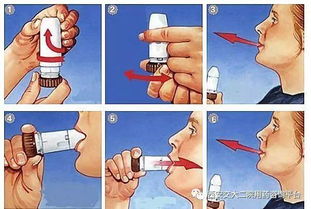 疏通管道中毒怎么赔偿的(管道疏通剂中毒症状)