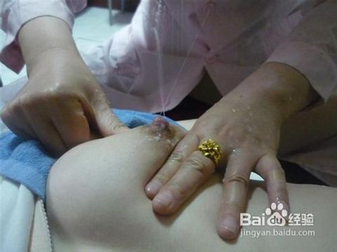 生产后怎么疏通母乳管道(生产后怎么疏通母乳管道堵塞)