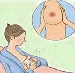 用嘴怎么疏通母乳管道(如何疏通母乳)