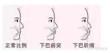 下垂管道堵了怎么疏通(水管下垂)