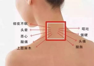 在家怎么疏通颈椎管道(在家怎么疏通颈椎管道呢)
